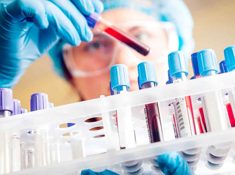 Xét nghiệm sàng lọc trước sinh NIPT