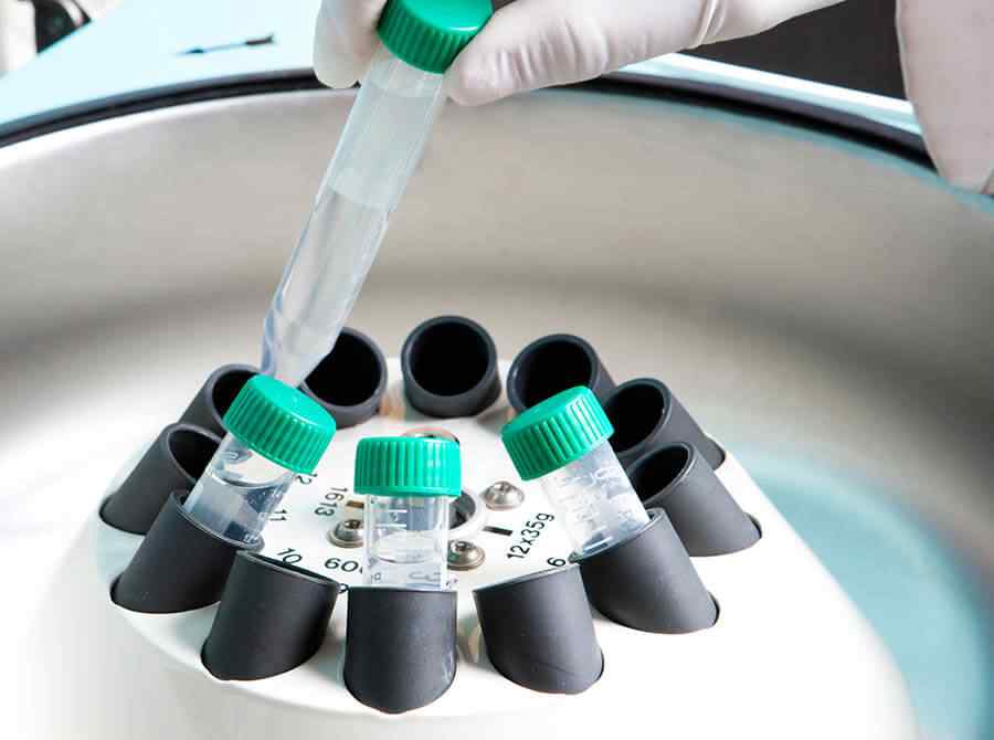 Xét nghiệm sinh học phân tử